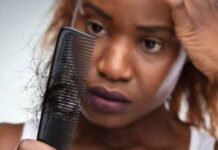 Hair Loss in Women: Causes, Treatment Hair Loss in Women