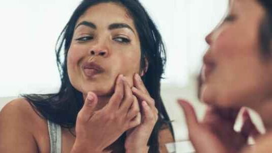 What is the Best Treatment for Pimples? What is the Best Treatment for Pimples