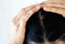 Your Guide to All Types of Hairlines (What’s Yours?) Your Guide to All Types of Hairlines