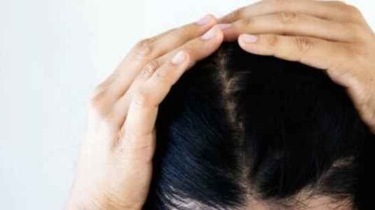 Your Guide to All Types of Hairlines (What’s Yours?) Your Guide to All Types of Hairlines