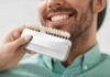 The Different Types of Veneers: A Basic Guide The Different Types of Veneers: A Basic Guide
